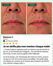 Huile Ayanoa — Le rituel coréen qui espace vos épilations